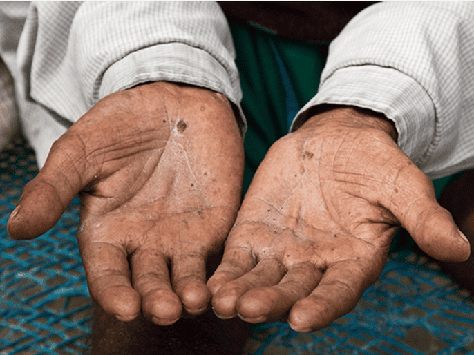 Xử Lý Nước Thô Đầu Nguồn – Nước Giếng Khoan – Nước Máy Đô Thị